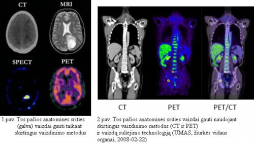 Jonizuojančioji spinduliuotė ir medicinos fizika: tyrimai pasaulyje ir Lietuvoje