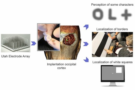 Utah Electrode Array veikimas © John A. Moran Eye Center at the University of Utah